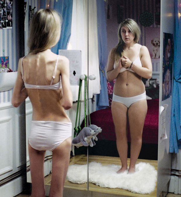 Страх приобрести лишний вес может стать фобией. Фото o-krohe.ru