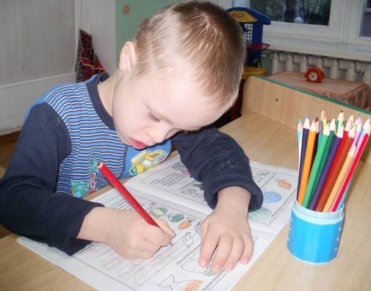 синдром Дауна